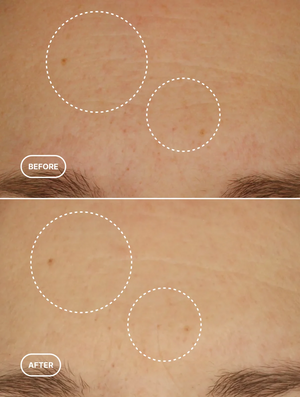 Anti-Age Retinol Alternative Serum