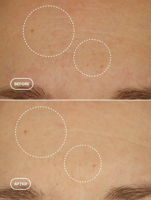 Anti-Age Retinol Alternative Serum