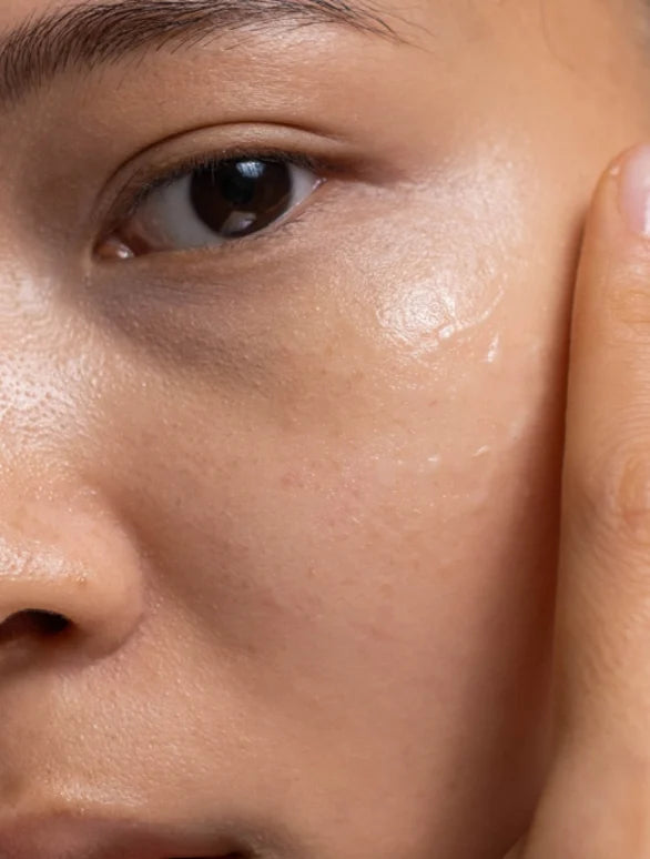Double Hydra Gel