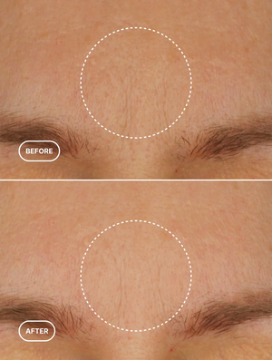 Anti-Age Retinol Alternative Moisturiser