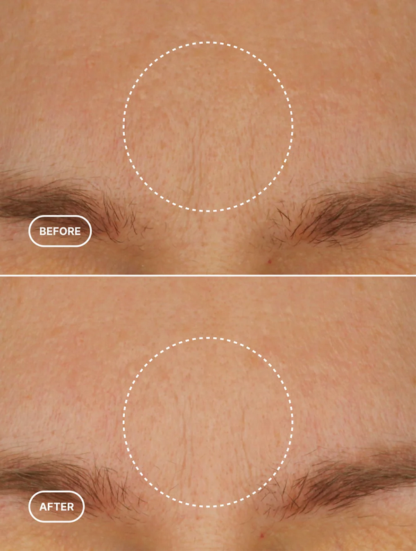 Anti-Age Retinol Alternative Moisturiser